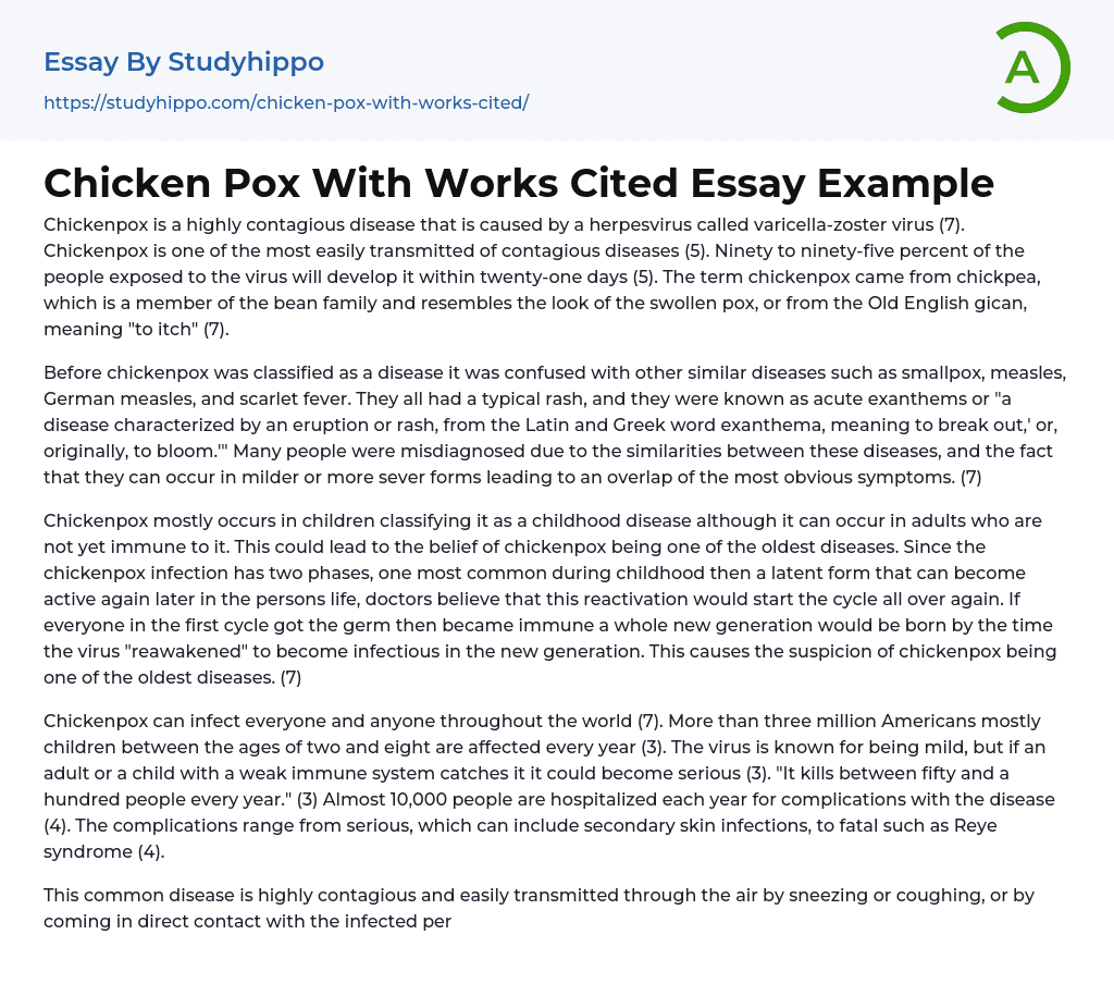 Chicken Pox With Works Cited Essay Example