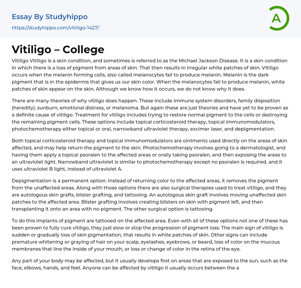 Vitiligo – College Essay Example