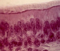 Pseudostratified ciliated columnar epithelium