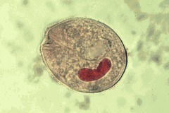 Balantidium coli trophozoite