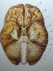 IV Trochlear Nerve