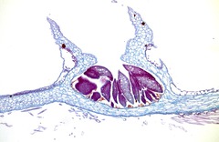 Marchantia Gemmae