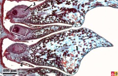 megagametophyte