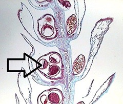 megasporangium