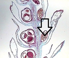 microsporangium