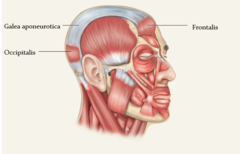 Occipital frontalis