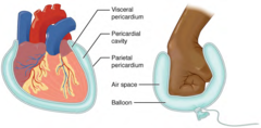 pericardium