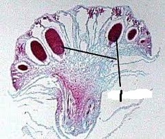 Polytrichum Antheridia