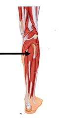 Tibialis posterior
