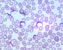 Trypanosoma brucei rhodesiense