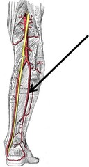 What are the two main divisions of the common fibular nerve?