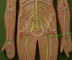 What is the largest and longest nerve in the body? It arises from the sacral plexus.