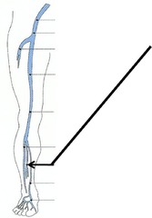 What nerve is formed from the posterior division of the sciatic nerve?