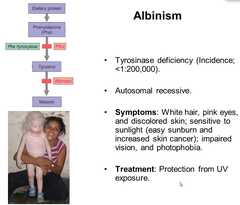 Albinism: etiologies (+ genetics, when applicable)?