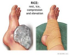 Ankle sprain