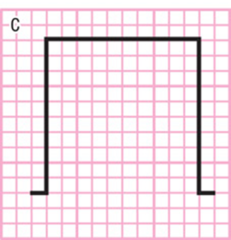 Another calibration you may run across is one in which the paper speed is set to _______________, instead of the traditional 25mm/sec.