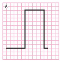 At the end of each EKG strip, you will usually find a step like structure called a _______________.