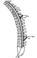 At what level do spinous process meet their maximal angulation?