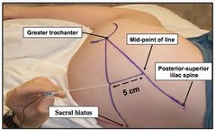 Blockade of which nerve provides anesthesia for many surgical procedures involving the hip, knee, or distal lower extremity?