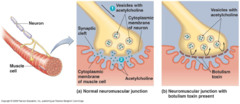 Botulism toxin mechanism?