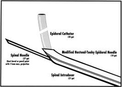 Combination epidural/ SAB Placement