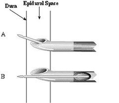 Combination needle