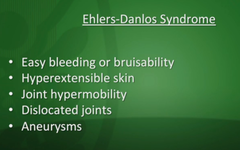 *Ehlers-Danlos syndrome*: what is it basically? what are the signs/sx?