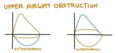 Flow volume Loops