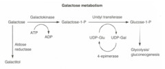 Galactokinase deficiency: