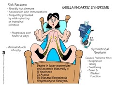 Guillain Barre Syndrome