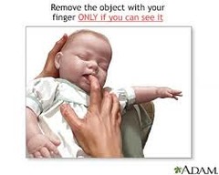 If you can see an object in the infants/child's mouth what technique do you use?