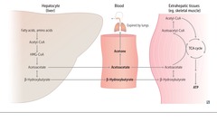 Ketone bodies