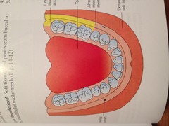 Long Buccal Nerve Block: area anesthetized