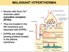 Malignant hyperthermia and anesthetics