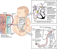 Neonatal circulation