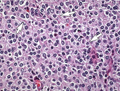 Oligodendrocytes = fried eggs cells