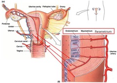 parametrium