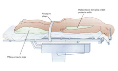 Prone position