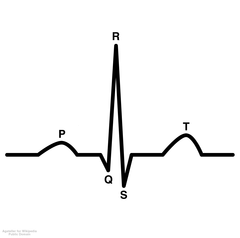 QRS Complex