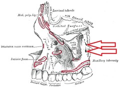 What are the landmarks for administering a PSA nerve block?