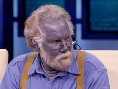 What does cyanosis mean?