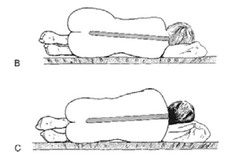 What factors need to be considered in regards to lateral positioning in men & women, especially w/ spinals?
