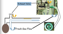 What is a non rebreathing circuit?  What does CO2 removal depend on?  What is fresh gas flow set at?