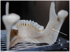 Where is the target site for the needle in an inferior alveolar nerve block?