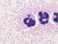 Anaplasma phagocytophilium