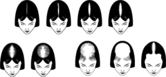 Androgenetic Alopecia - Female