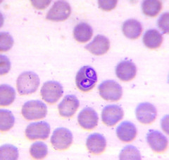 Babesia