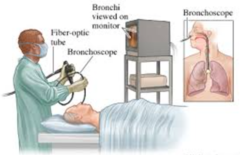 Bronchoscopy procedure