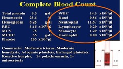 wbc cbc differential automated disorders hematology studyhippo