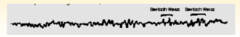 Characteristics of REM sleep EEG